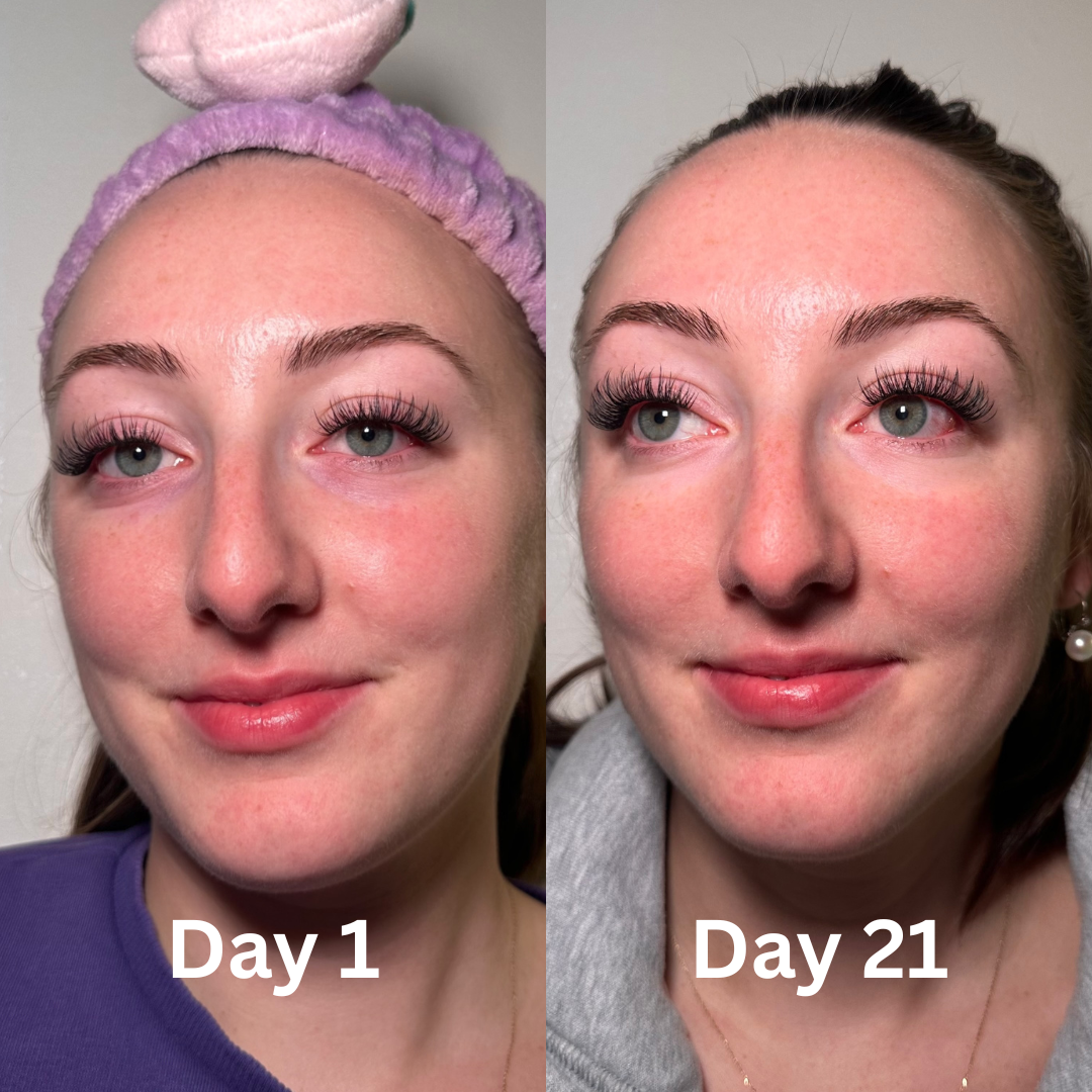 Lumi UnderEye