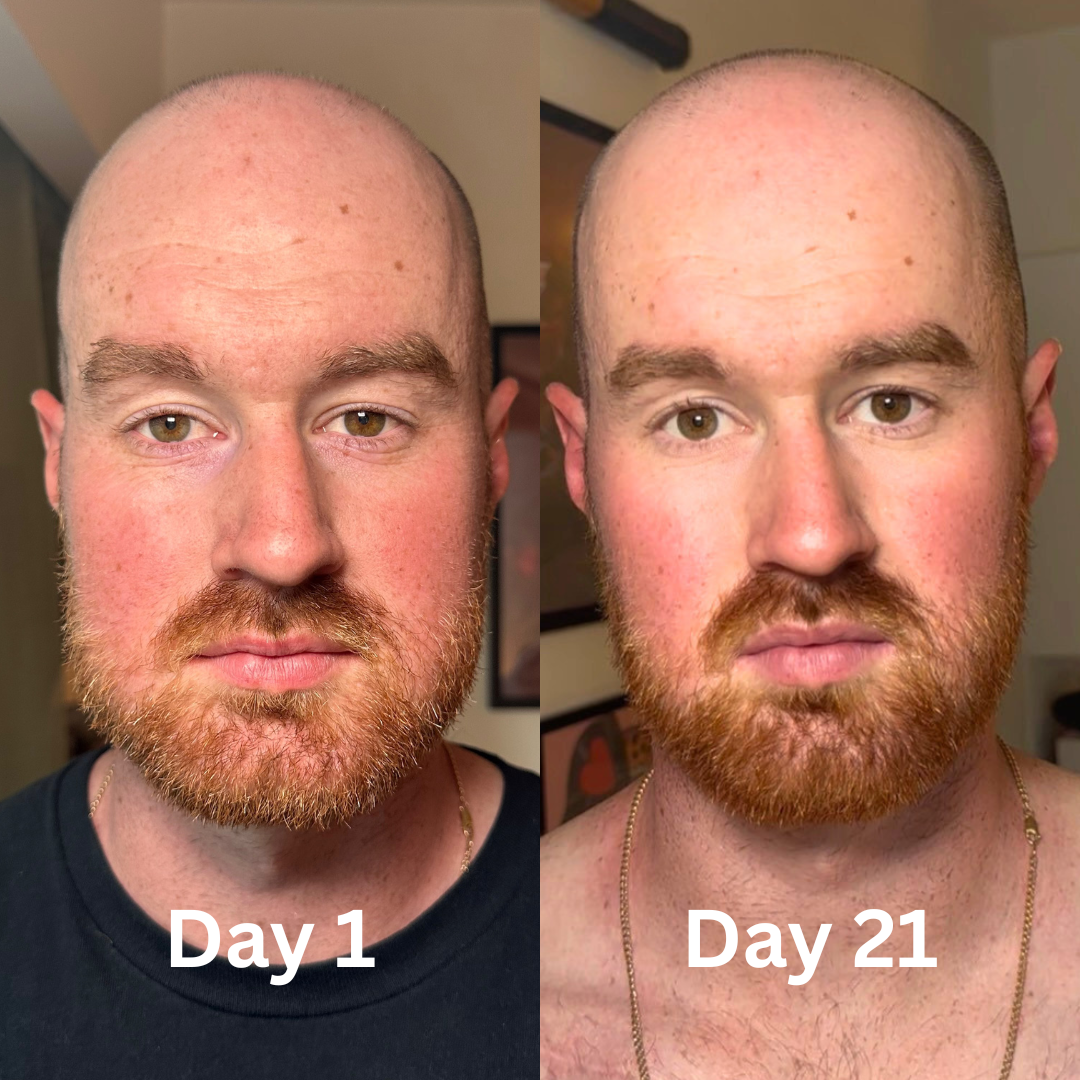 Lumi UnderEye